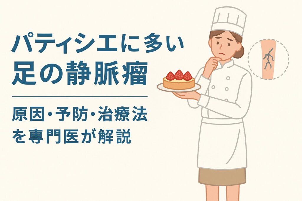 パティシエに多い足の静脈瘤｜原因・予防・治療法を専門医が解説