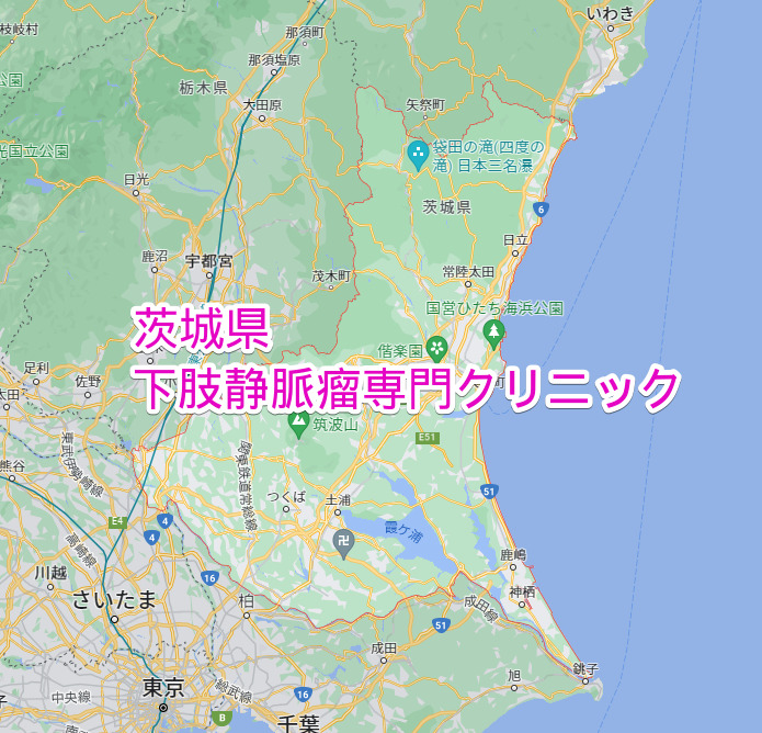 茨城県 下肢静脈瘤専門クリニック