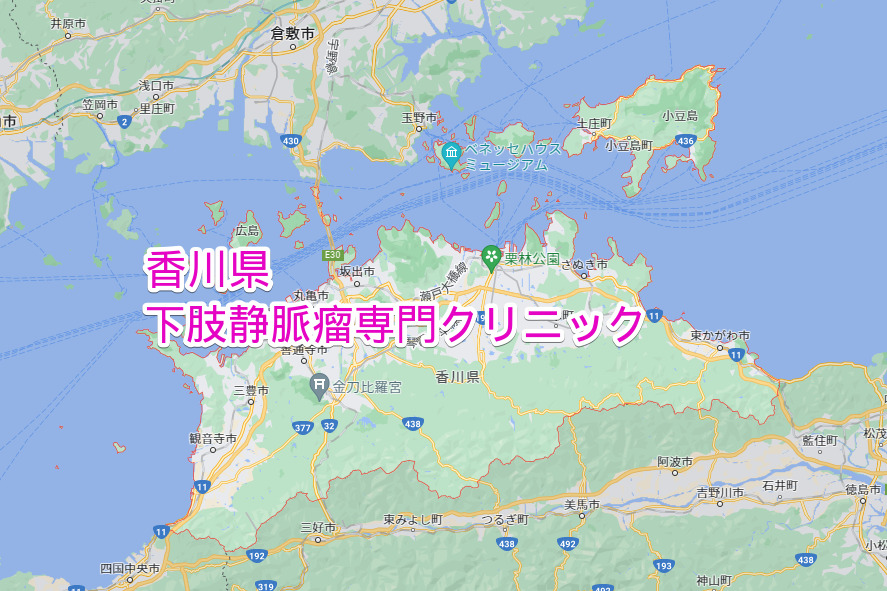 香川県 下肢静脈瘤専門クリニック
