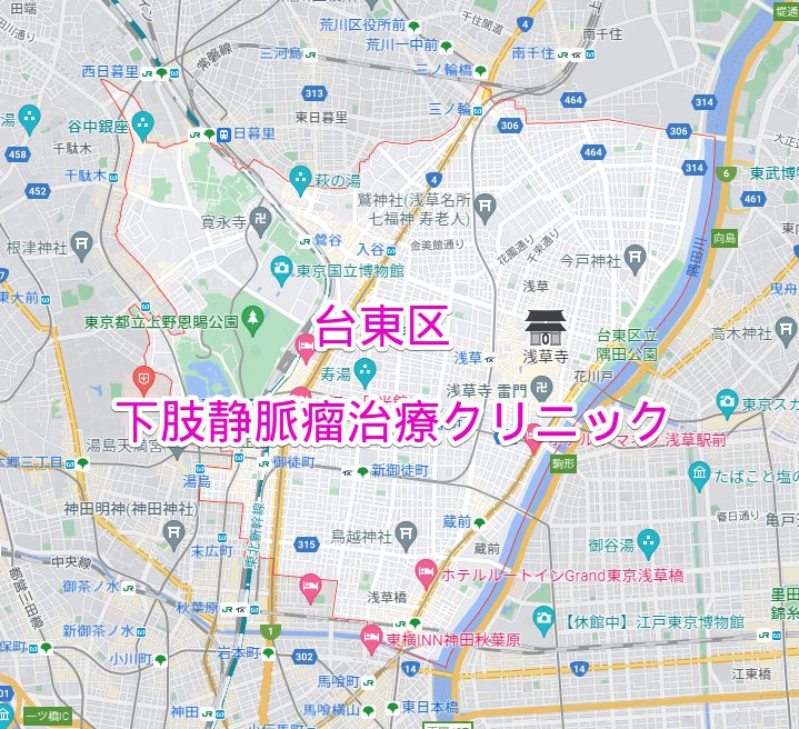 台東区 下肢静脈瘤治療施術クリニック