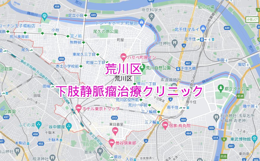 荒川区 下肢静脈瘤治療クリニック病院