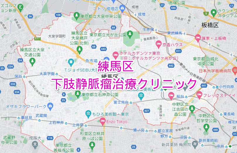 練馬区 下肢静脈瘤治療専門病院