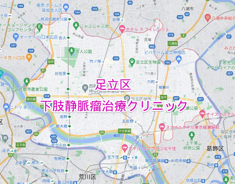 足立区 下肢静脈瘤治療クリニック専門病院