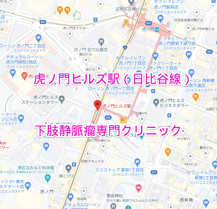 虎ノ門ヒルズ駅（日比谷線）下肢静脈瘤専門クリニック