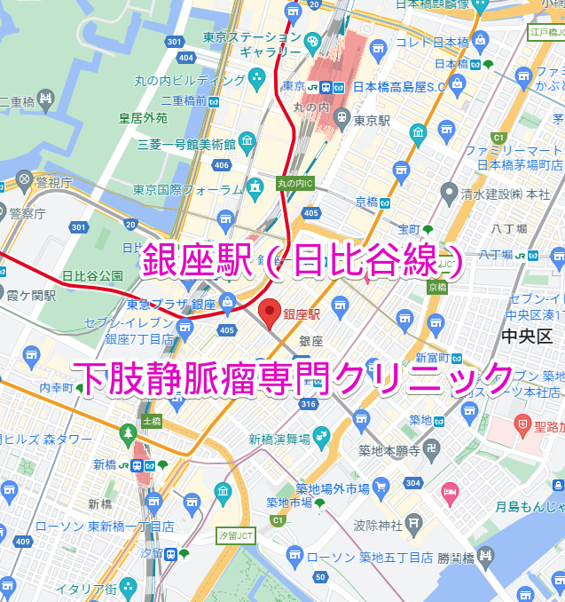 銀座駅（日比谷線）下肢静脈瘤専門クリニック