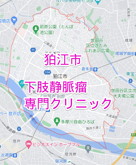 狛江市の下肢静脈瘤専門クリニック