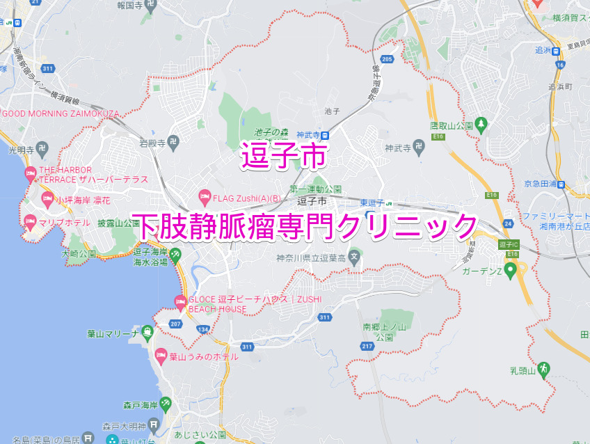 逗子市の下肢静脈瘤専門クリニック