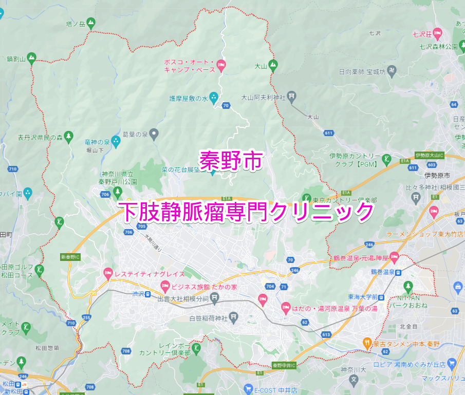 秦野市の下肢静脈瘤専門クリニック