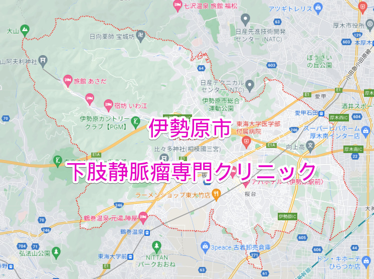 伊勢原市の下肢静脈瘤専門クリニック