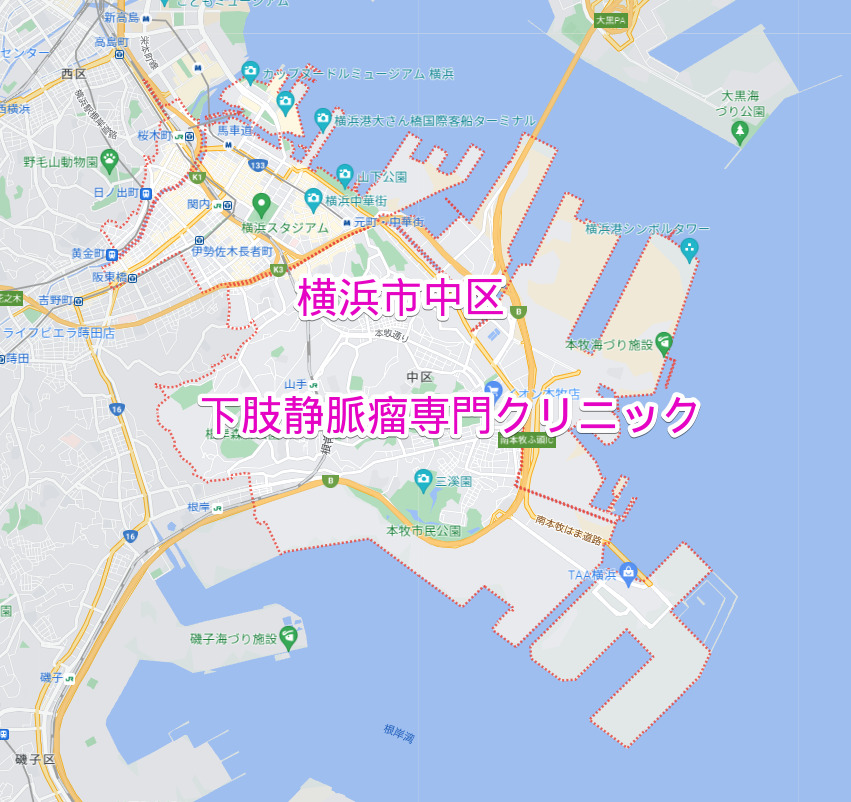 横浜市中区の下肢静脈瘤専門クリニック