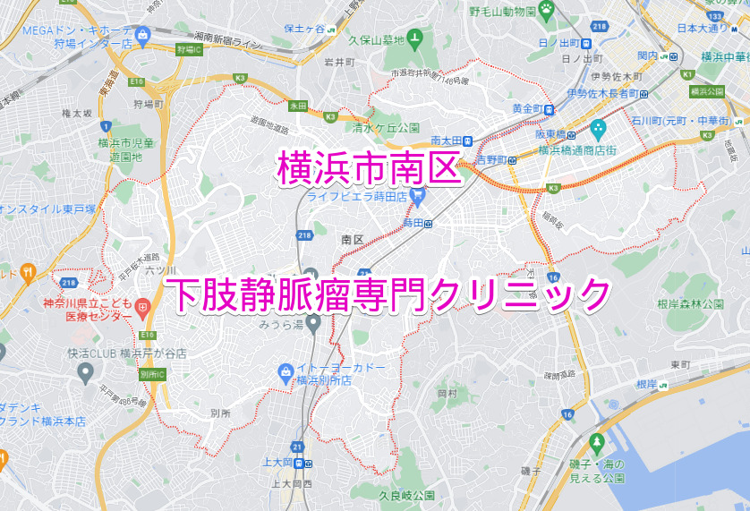 横浜市南区の下肢静脈瘤専門クリニック
