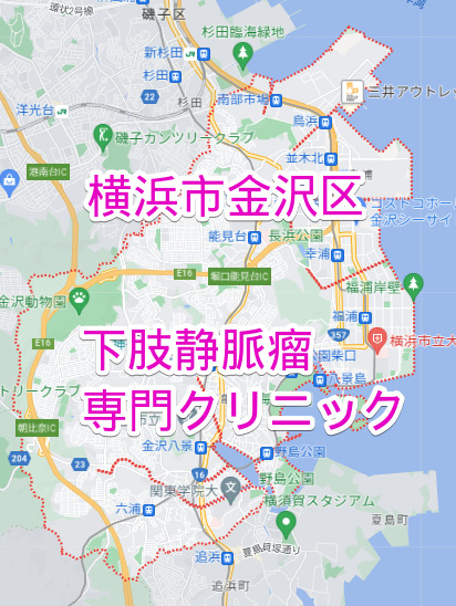 横浜市金沢区の下肢静脈瘤専門クリニック