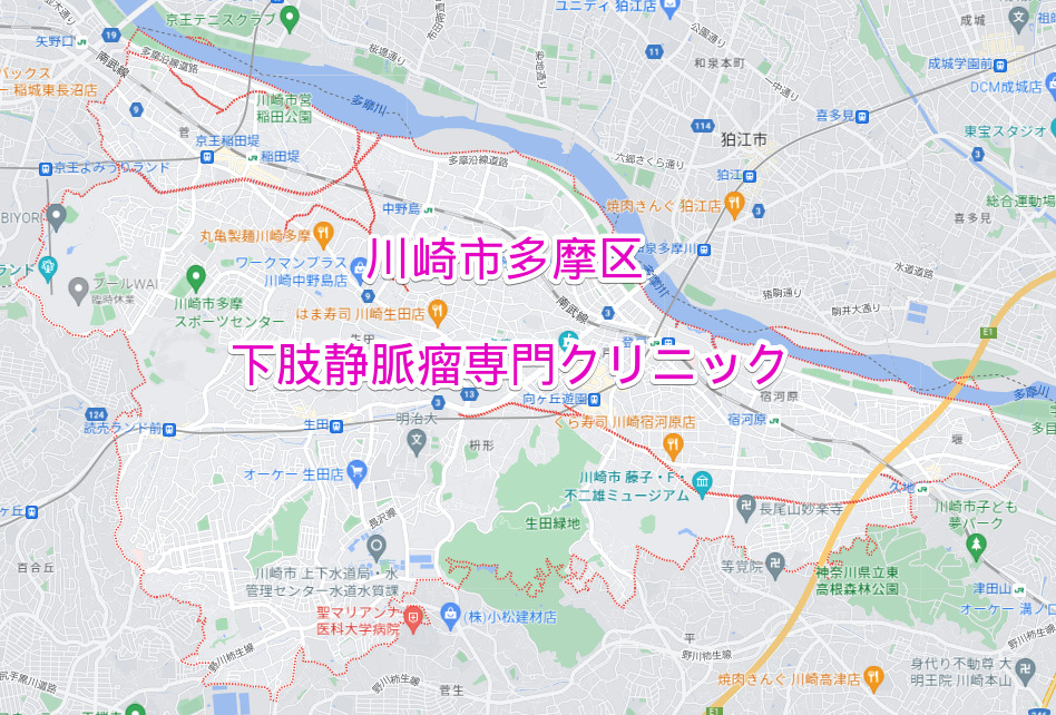 川崎市多摩区の下肢静脈瘤専門クリニック