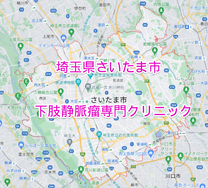 埼玉県さいたま市の下肢静脈瘤専門クリニック