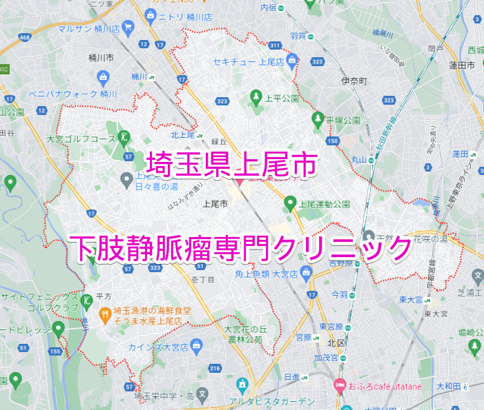埼玉県上尾市の下肢静脈瘤専門クリニック