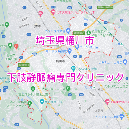 埼玉県桶川市の下肢静脈瘤専門クリニック