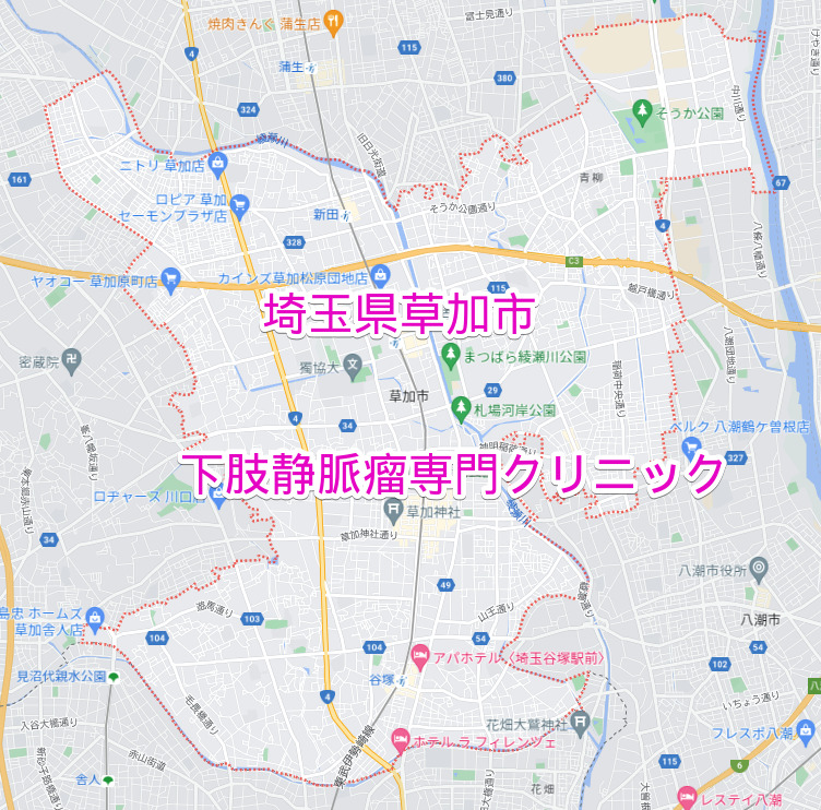 埼玉県草加市の下肢静脈瘤専門クリニック