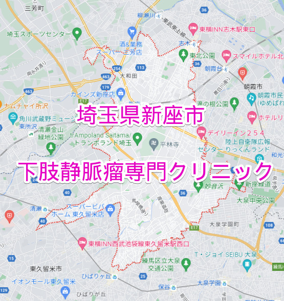 埼玉県新座市の下肢静脈瘤専門クリニック