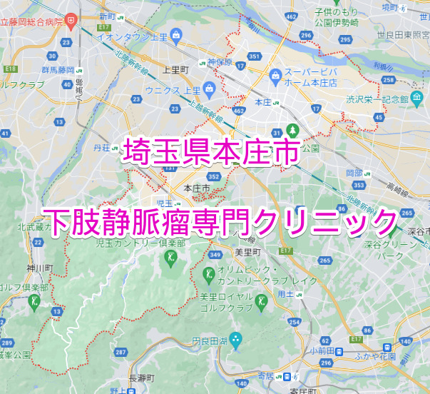 埼玉県本庄市の下肢静脈瘤専門クリニック