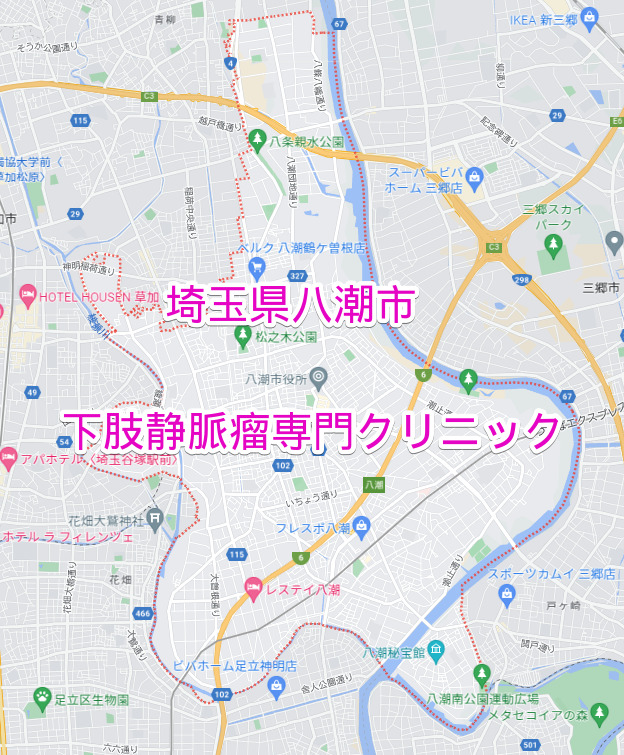 埼玉県八潮市の下肢静脈瘤専門クリニック