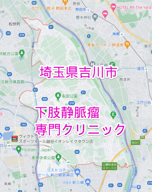 埼玉県吉川市の下肢静脈瘤専門クリニック