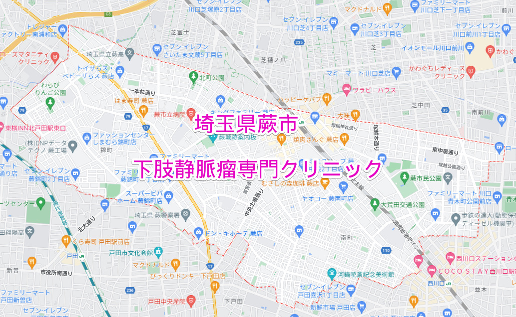 埼玉県蕨市の下肢静脈瘤専門クリニック