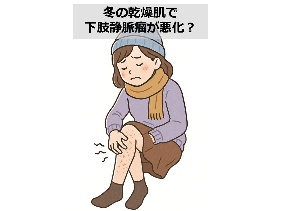 【血管外科医監修】冬は下肢静脈瘤悪化に要注意｜乾燥による皮膚トラブルとその対策