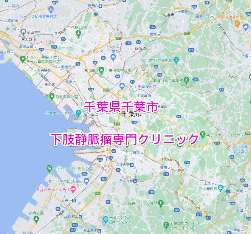 千葉県千葉市の下肢静脈瘤専門クリニック