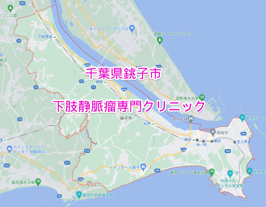 千葉県銚子市の下肢静脈瘤専門クリニック