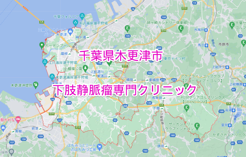 千葉県木更津市の下肢静脈瘤専門クリニック