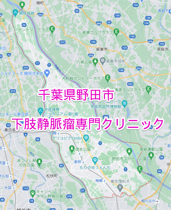 千葉県野田市の下肢静脈瘤専門クリニック