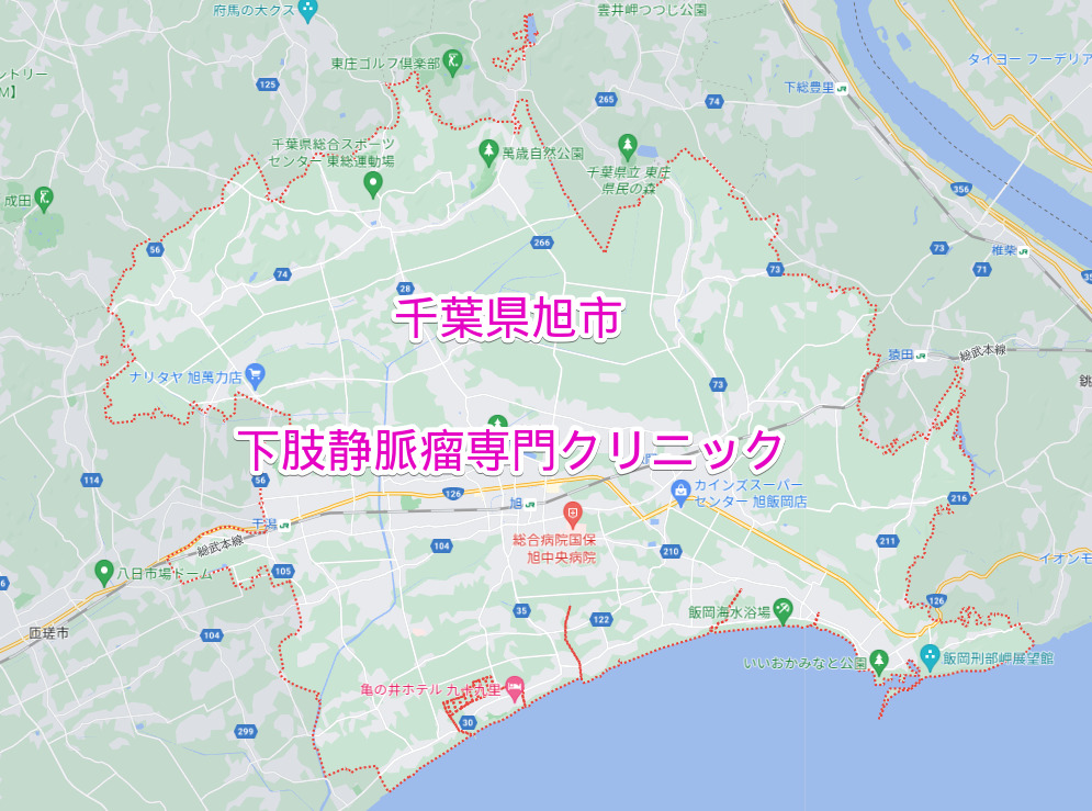 千葉県旭市の下肢静脈瘤専門クリニック