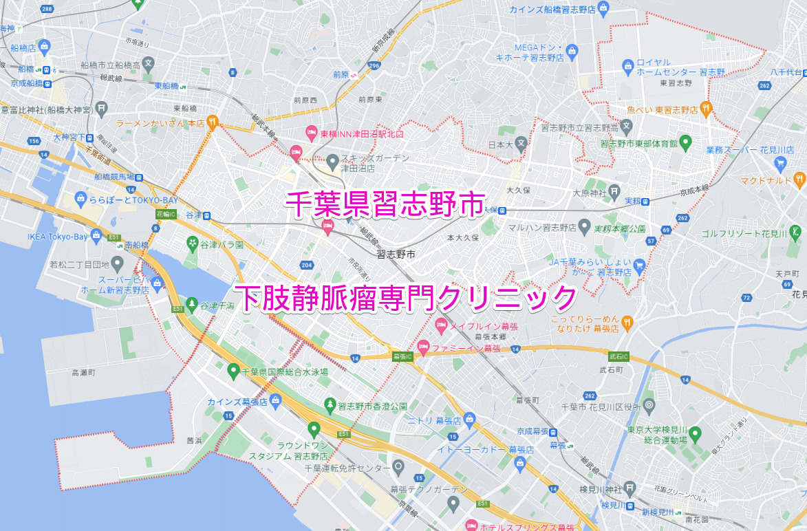 千葉県習志野市の下肢静脈瘤専門クリニック