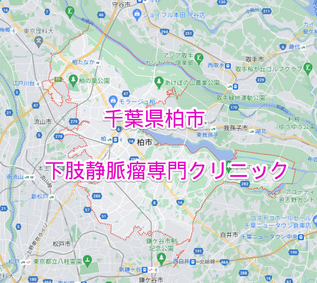 千葉県柏市の下肢静脈瘤専門クリニック
