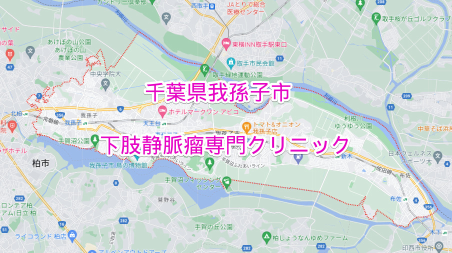 千葉県我孫子市の下肢静脈瘤専門クリニック