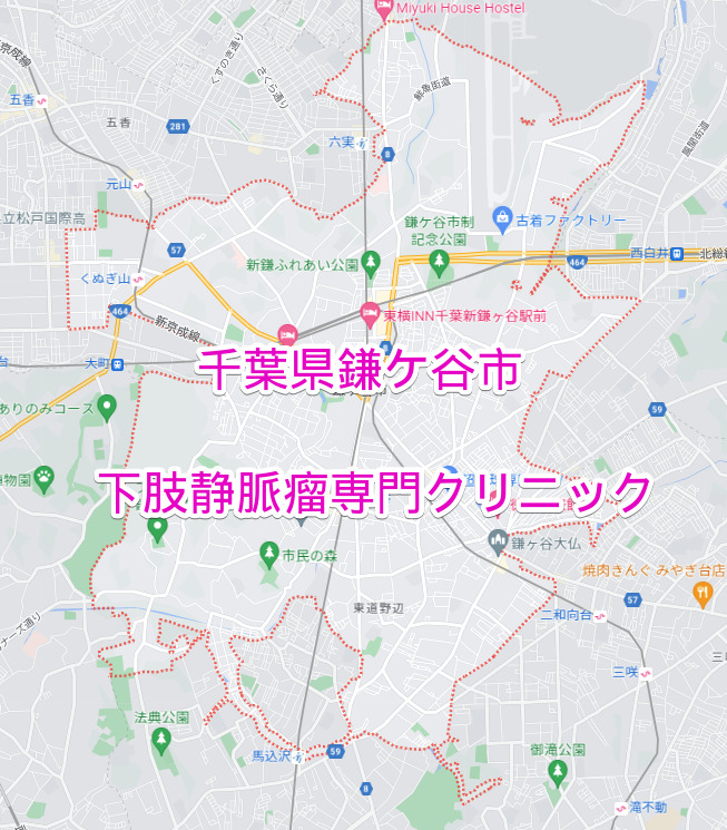 千葉県鎌ケ谷市の下肢静脈瘤専門クリニック