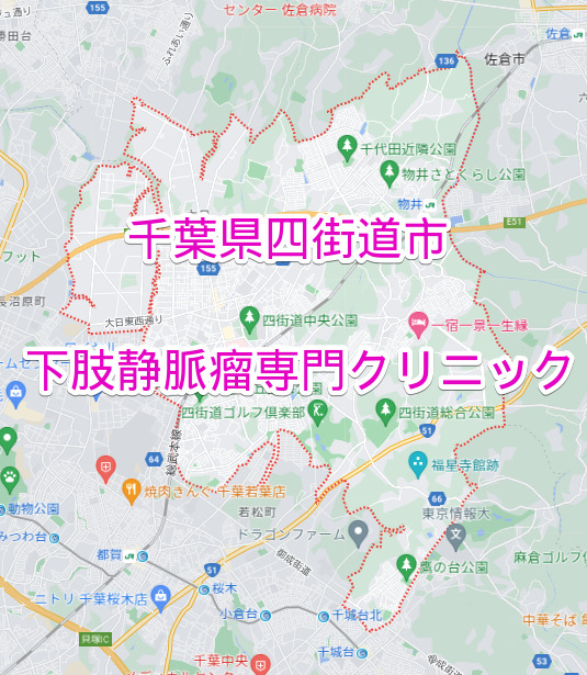 千葉県四街道市の下肢静脈瘤専門クリニック
