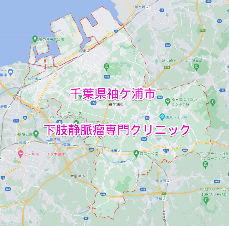千葉県袖ケ浦市の下肢静脈瘤専門クリニック
