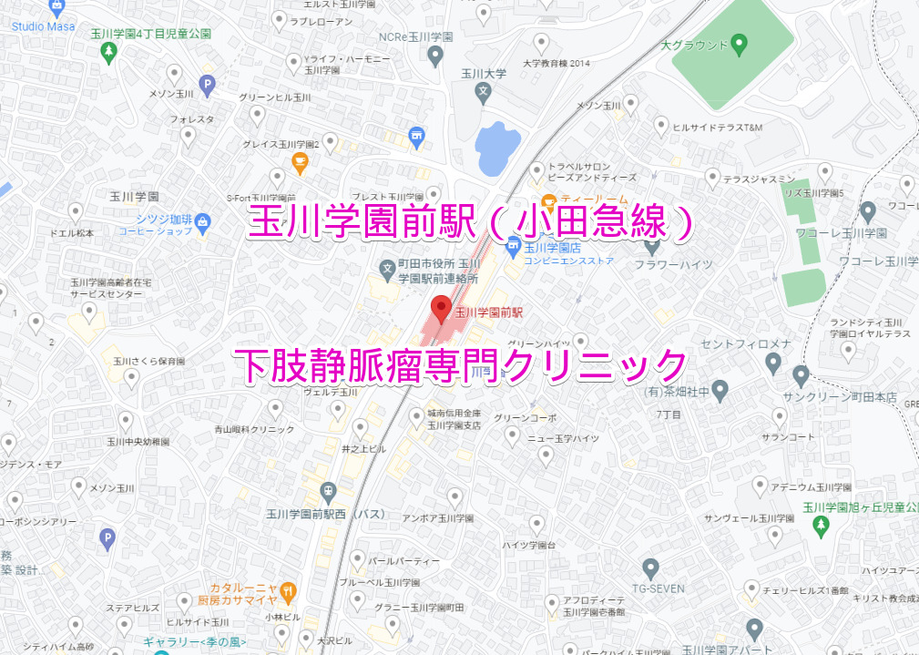 小田急線玉川学園前駅の下肢静脈瘤専門クリニック