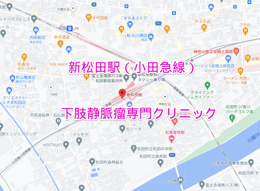 新松田駅（小田急線）の下肢静脈瘤専門クリニック