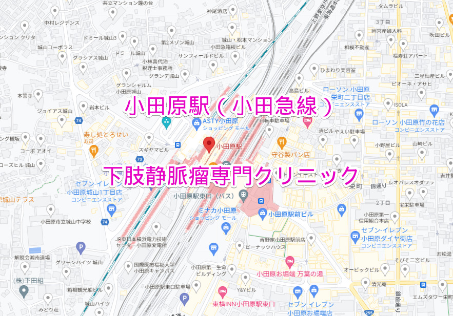 小田原駅（小田急線）の下肢静脈瘤専門クリニック