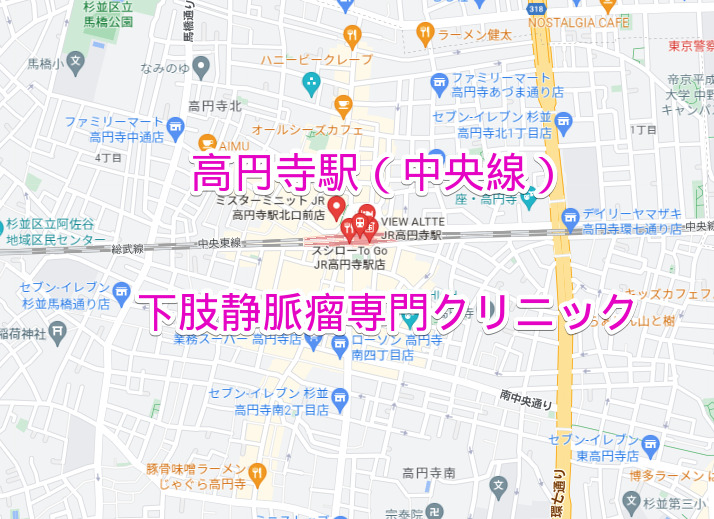 JR中央線高円寺駅の下肢静脈瘤専門クリニック