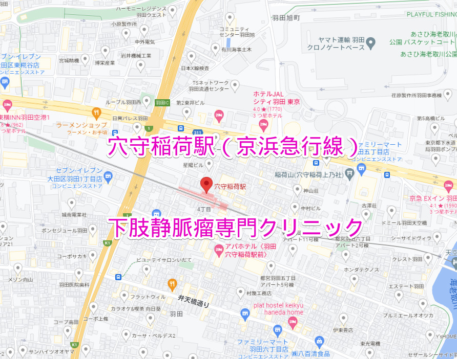 穴守稲荷駅（京浜急行線）の下肢静脈瘤専門クリニック