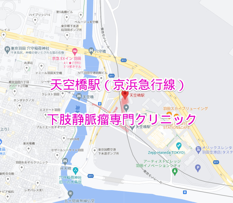 天空橋駅（京浜急行線）の下肢静脈瘤専門クリニック