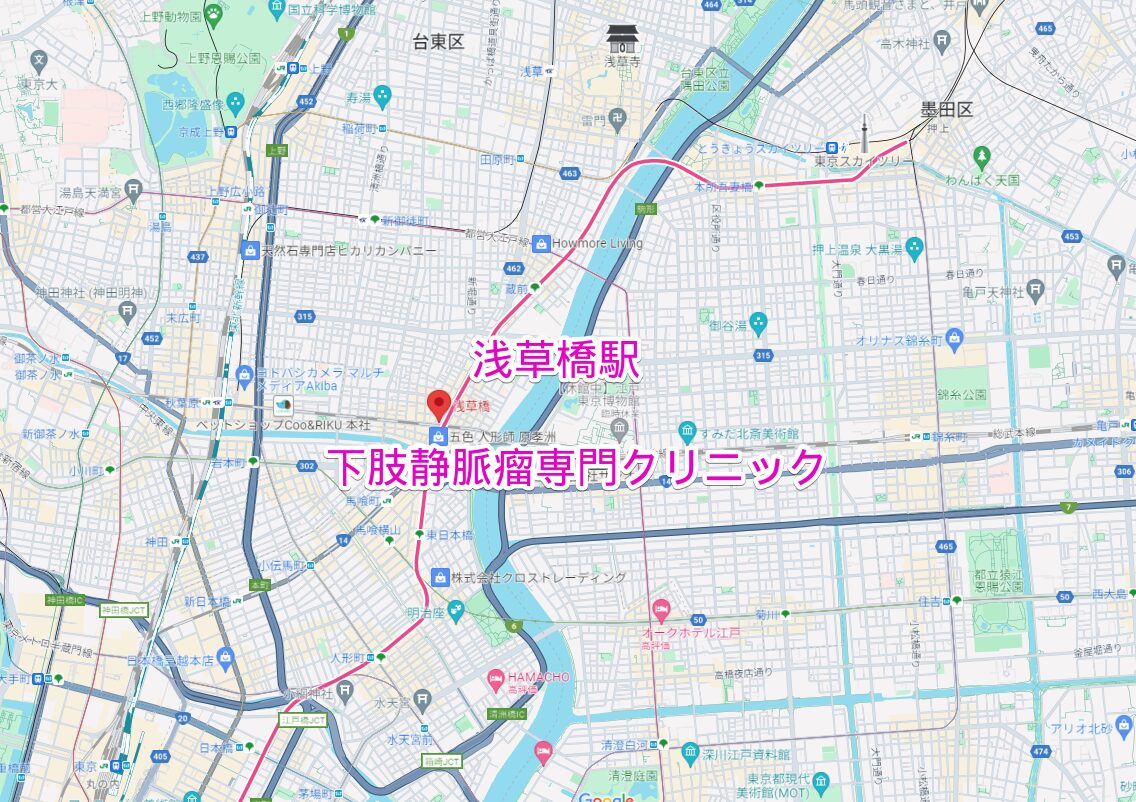 浅草橋駅周辺の下肢静脈瘤専門クリニック