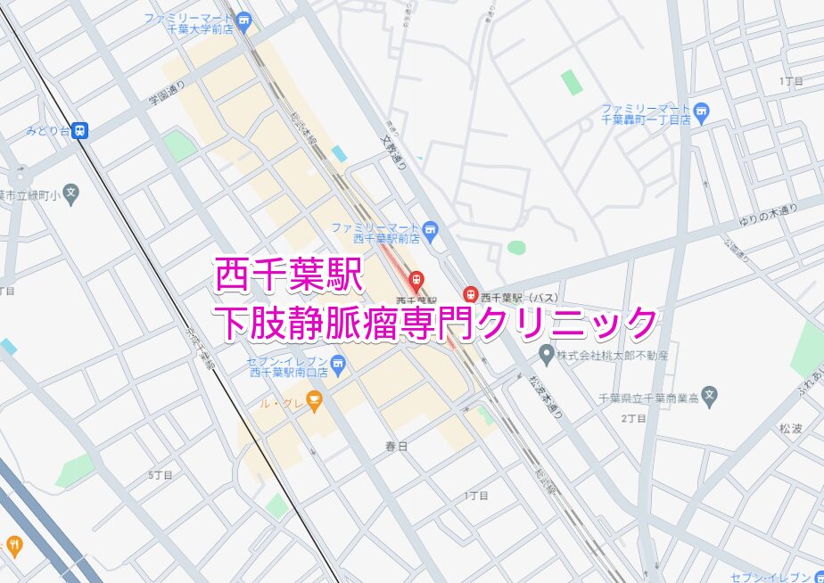 西千葉駅周辺の下肢静脈瘤専門クリニック