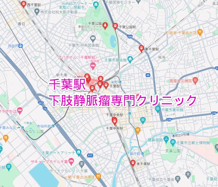 千葉駅周辺の下肢静脈瘤専門クリニック