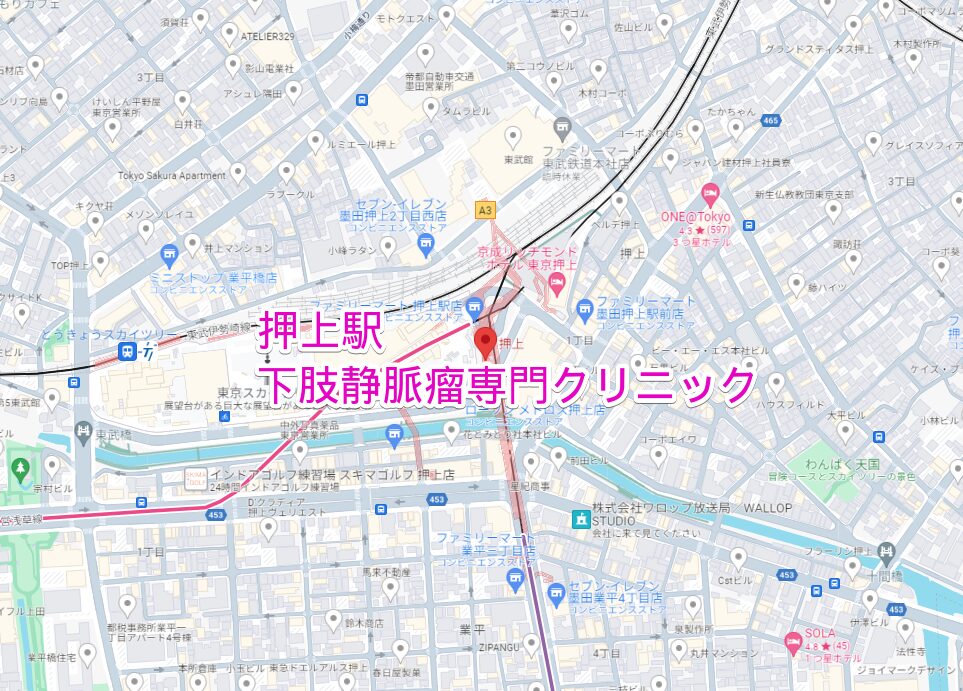 押上駅周辺の下肢静脈瘤専門クリニック