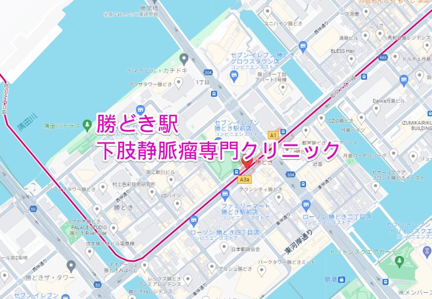 勝どき駅周辺の下肢静脈瘤専門クリニック