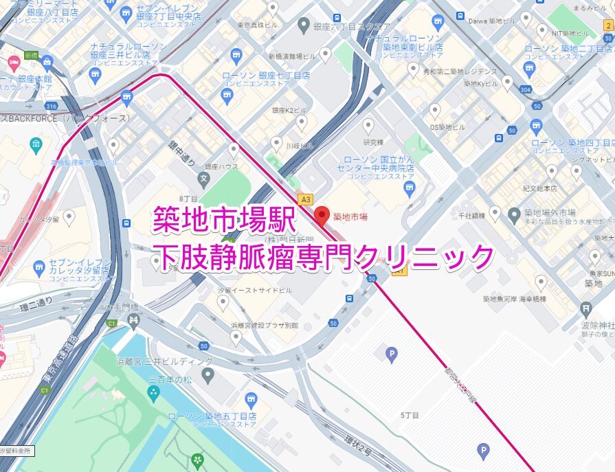 築地市場駅周辺の下肢静脈瘤専門クリニック